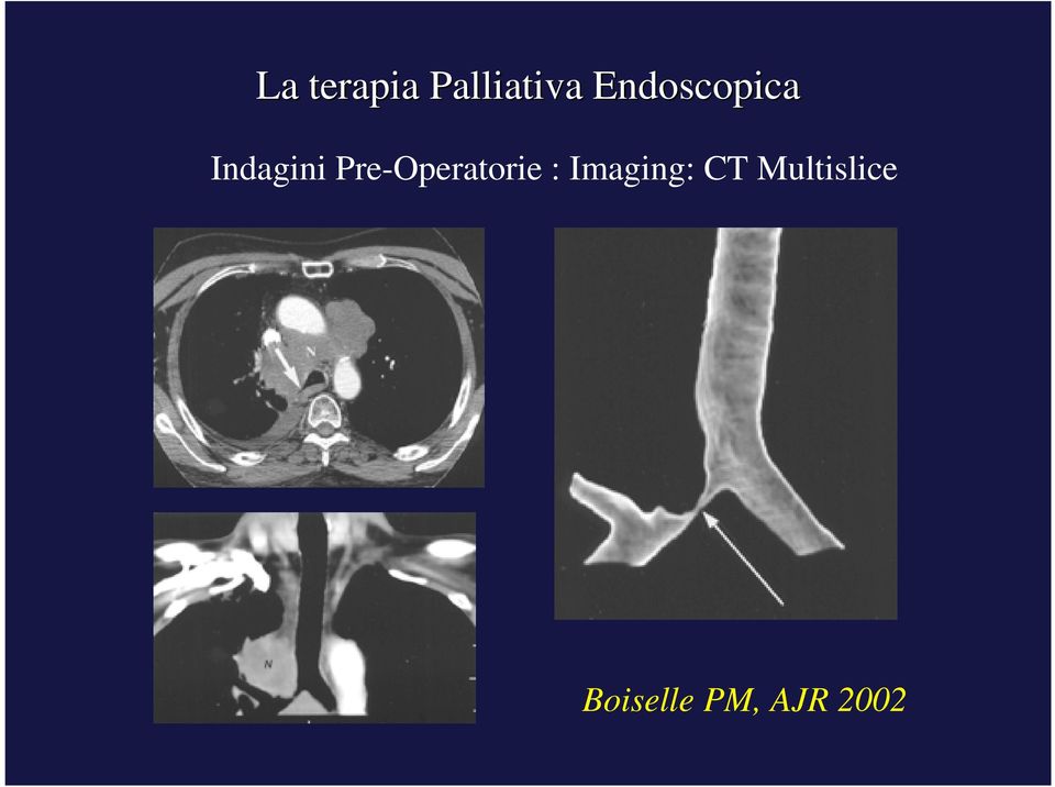 Pre-Operatorie : Imaging: