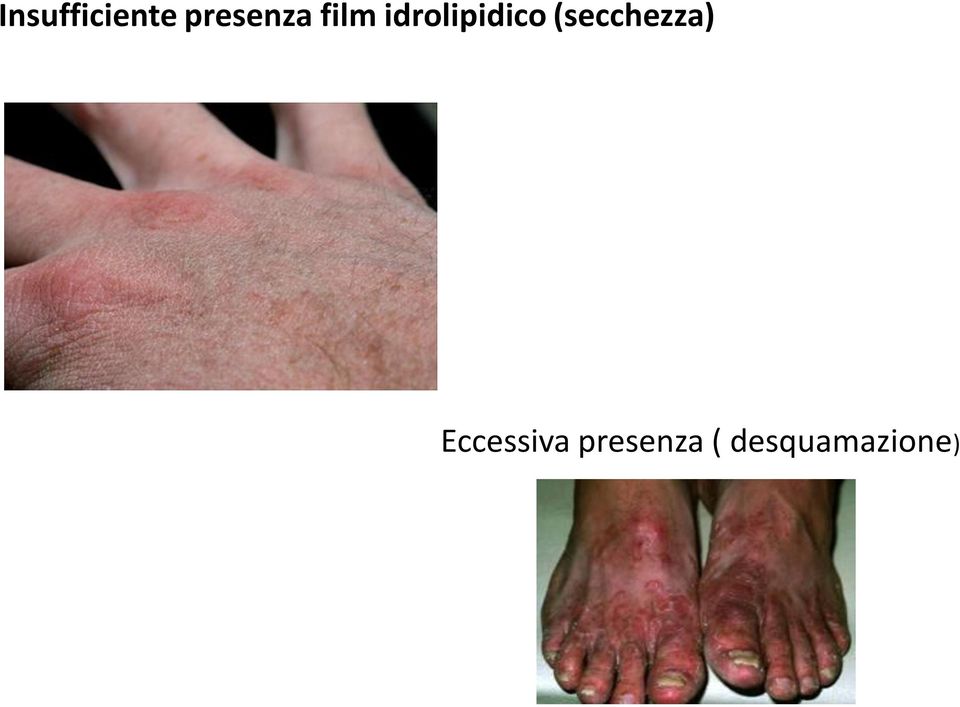 idrolipidico