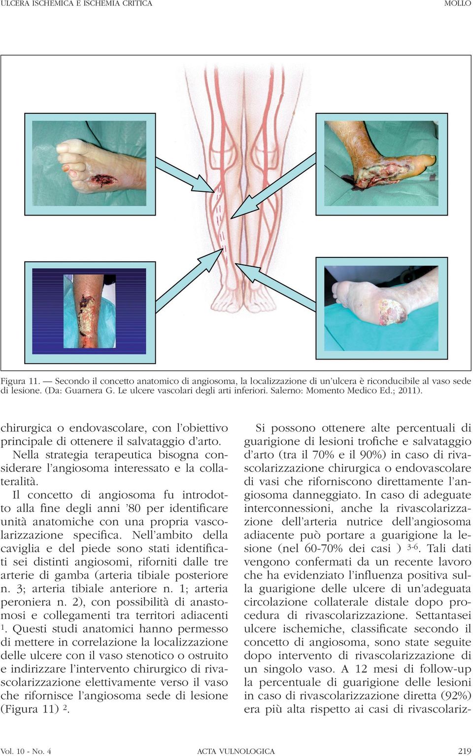 Si possono ottenere alte percentuali di guarigione di lesioni trofiche e salvataggio d arto (tra il 70% e il 90%) in caso di rivascolarizzazione chirurgica o endovascolare di vasi che riforniscono