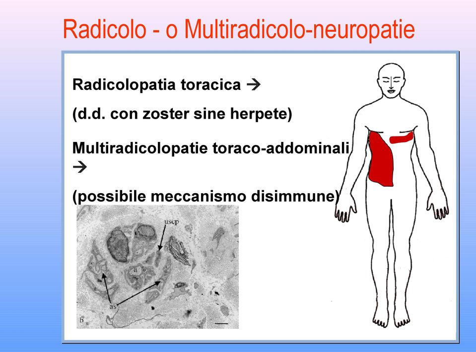 sine herpete) Multiradicolopatie