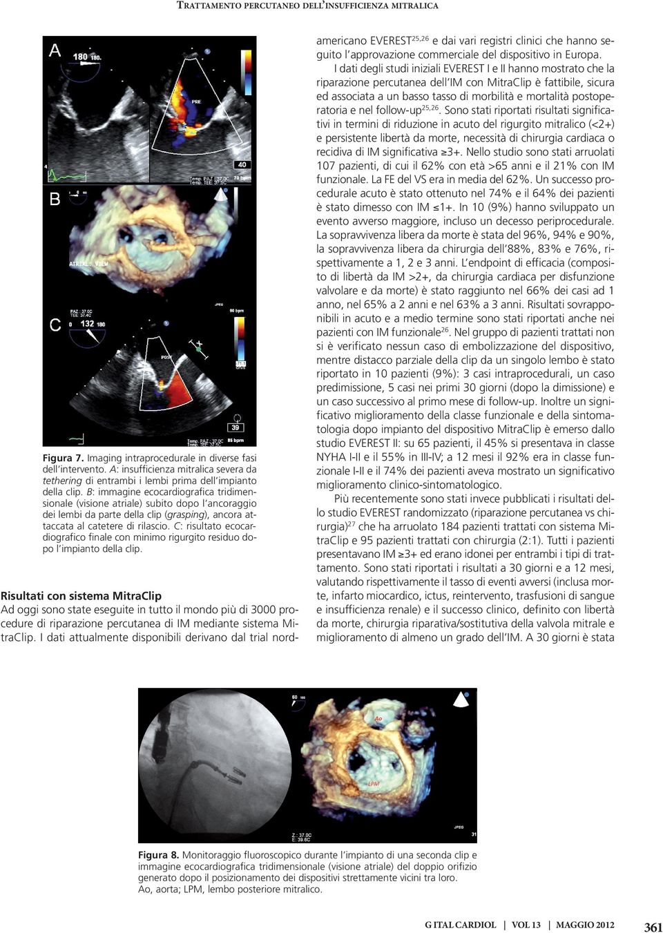 B: immagine ecocardiografica tridimensionale (visione atriale) subito dopo l ancoraggio dei lembi da parte della clip (grasping), ancora attaccata al catetere di rilascio.