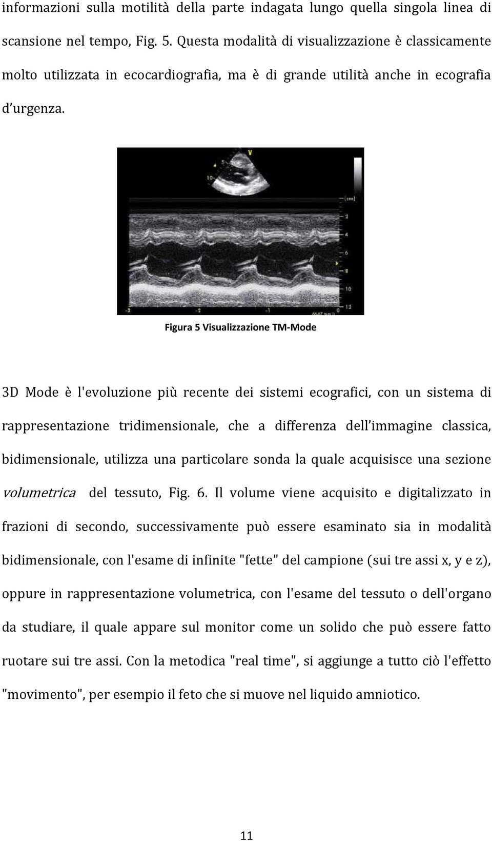 Figura 5 Visualizzazione TM-Mode 3D Mode è l'evoluzione più recente dei sistemi ecografici, con un sistema di rappresentazione tridimensionale, che a differenza dell immagine classica,