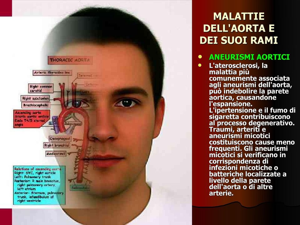 L'ipertensione e il fumo di sigaretta contribuiscono al processo degenerativo.