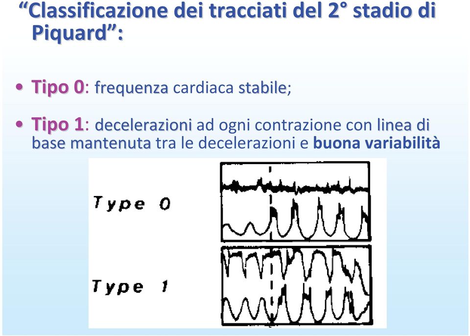 decelerazioniad ogni contrazione con linea di linea