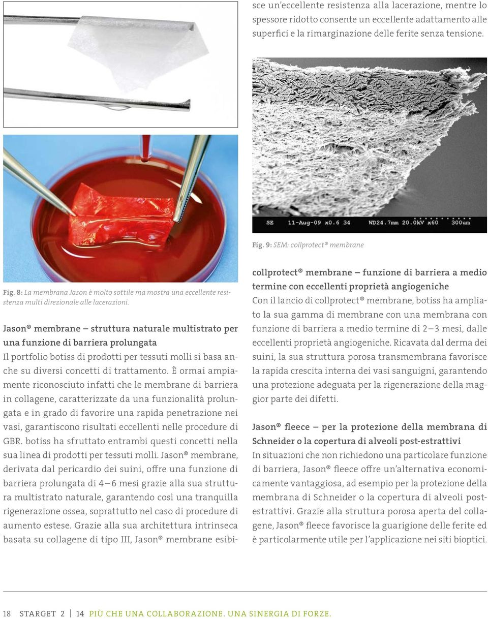 risultati eccellenti nelle procedure di GBR. botiss ha sfruttato entrambi questi concetti nella sua linea di prodotti per tessuti molli.