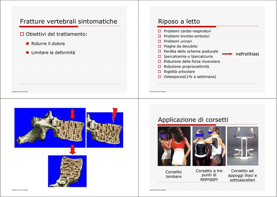 Ipercalcemia e Ipercalciuria nefrolitiasi Riduzione della forza muscolare Riduzione propriocettività Rigidità articolare