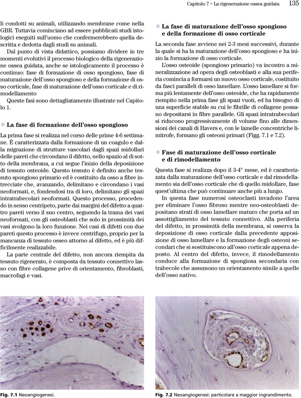 Dal punto di vista didattico, possiamo dividere in tre momenti evolutivi il processo biologico della rigenerazione ossea guidata, anche se istologicamente il processo è continuo: fase di formazione