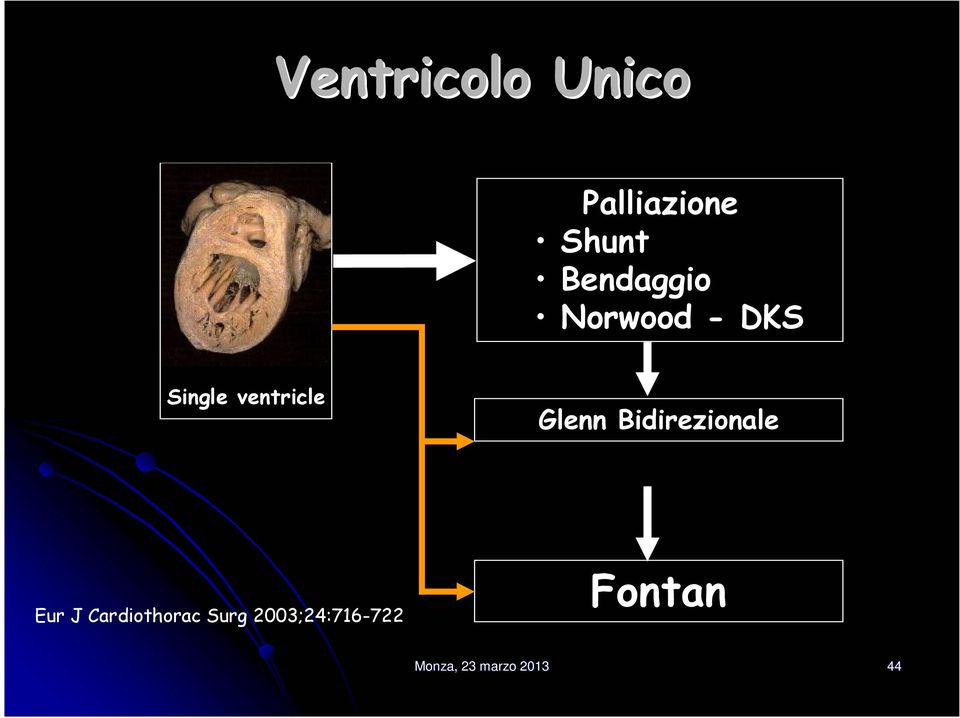 Glenn Bidirezionale Eur J Cardiothorac