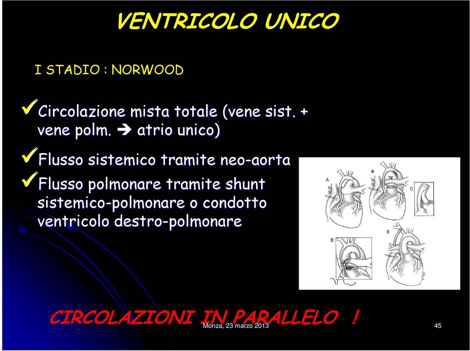 atrio unico) Flusso sistemico tramite neo-aorta Flusso polmonare