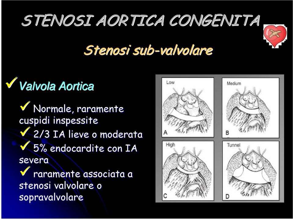 inspessite 2/3 IA lieve o moderata 5% endocardite