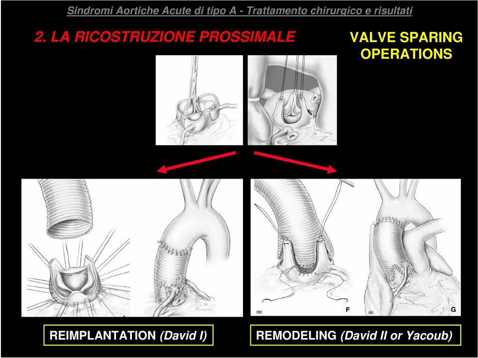 OPERATIONS REIMPLANTATION