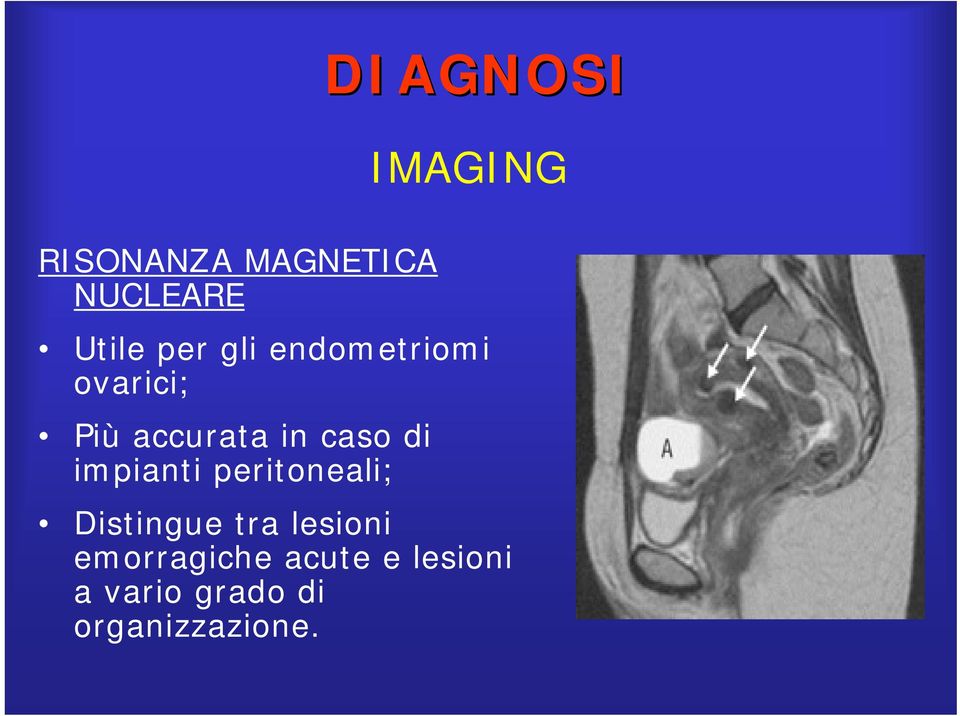 impianti peritoneali; IMAGING Distingue tra lesioni