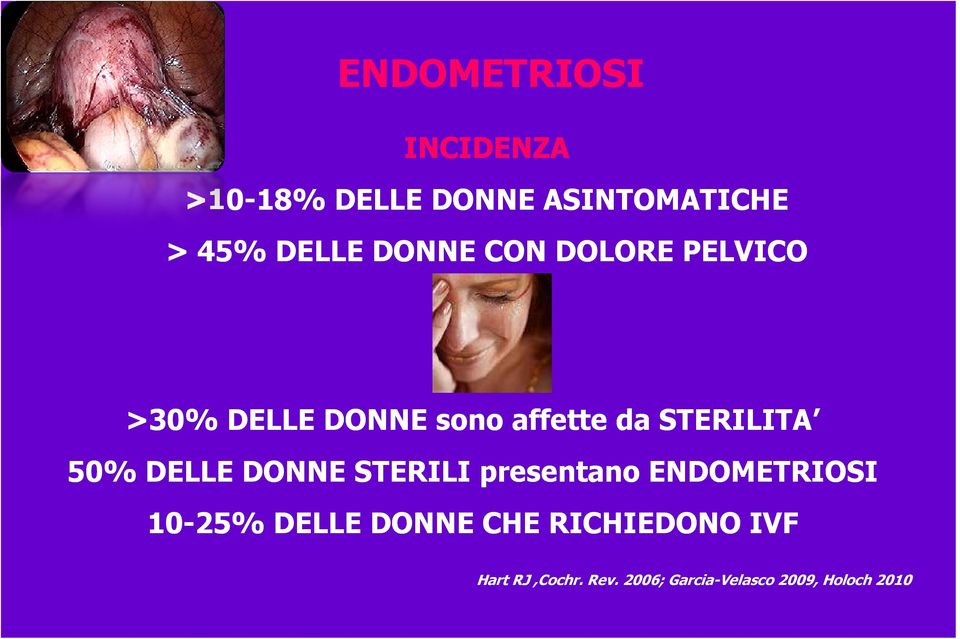 STERILITA 50% DELLE DONNE STERILI presentano ENDOMETRIOSI 10-25% DELLE