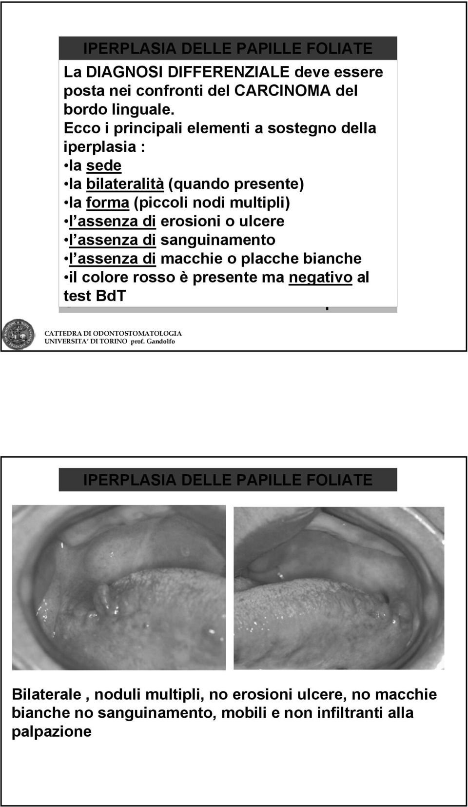 erosioni o ulcere l assenza di sanguinamento l assenza di macchie o placche bianche il colore rosso è presente ma negativo al test Solo BdT in casi