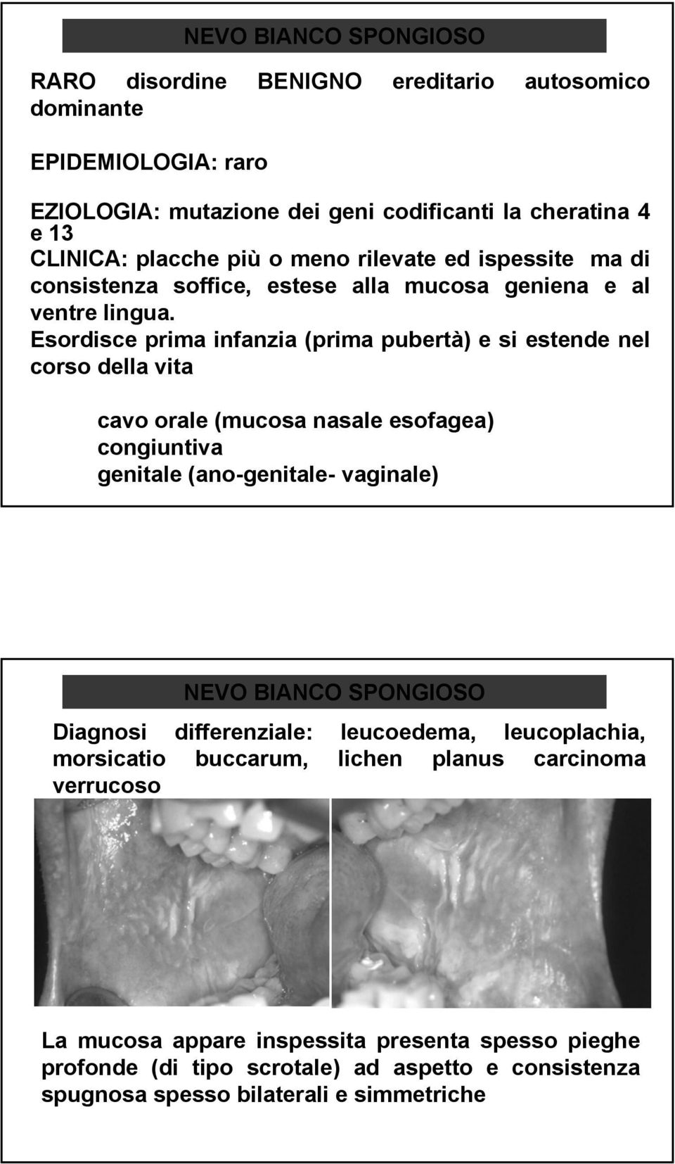 Esordisce prima infanzia (prima pubertà) e si estende nel corso della vita cavo orale (mucosa nasale esofagea) congiuntiva genitale (ano-genitale genitale- vaginale) NEVO BIANCO