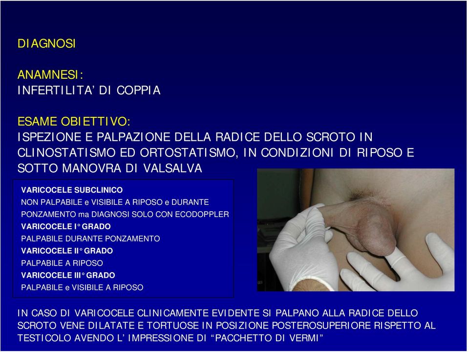 GRADO PALPABILE DURANTE PONZAMENTO VARICOCELE II GRADO PALPABILE A RIPOSO VARICOCELE III GRADO PALPABILE e VISIBILE A RIPOSO IN CASO DI VARICOCELE CLINICAMENTE