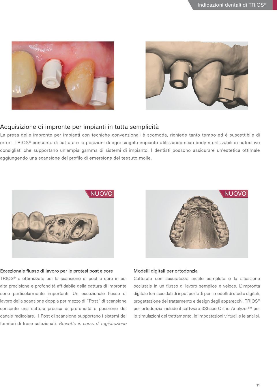 TRIOS consente di catturare le posizioni di ogni singolo impianto utilizzando scan body sterilizzabili in autoclave consigliati che supportano un ampia gamma di sistemi di impianto.