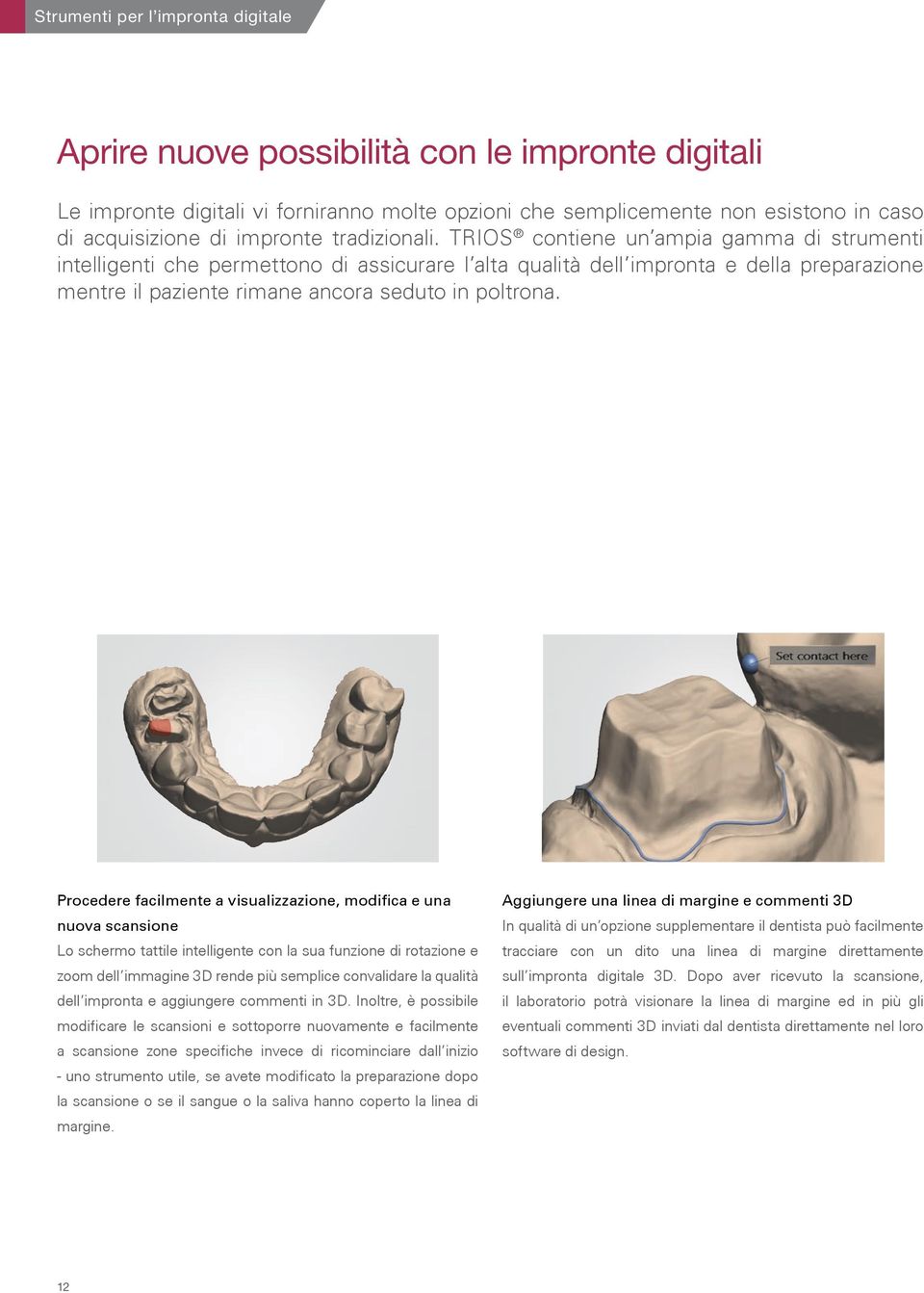 TRIOS contiene un ampia gamma di strumenti intelligenti che permettono di assicurare l alta qualità dell impronta e della preparazione mentre il paziente rimane ancora seduto in poltrona.