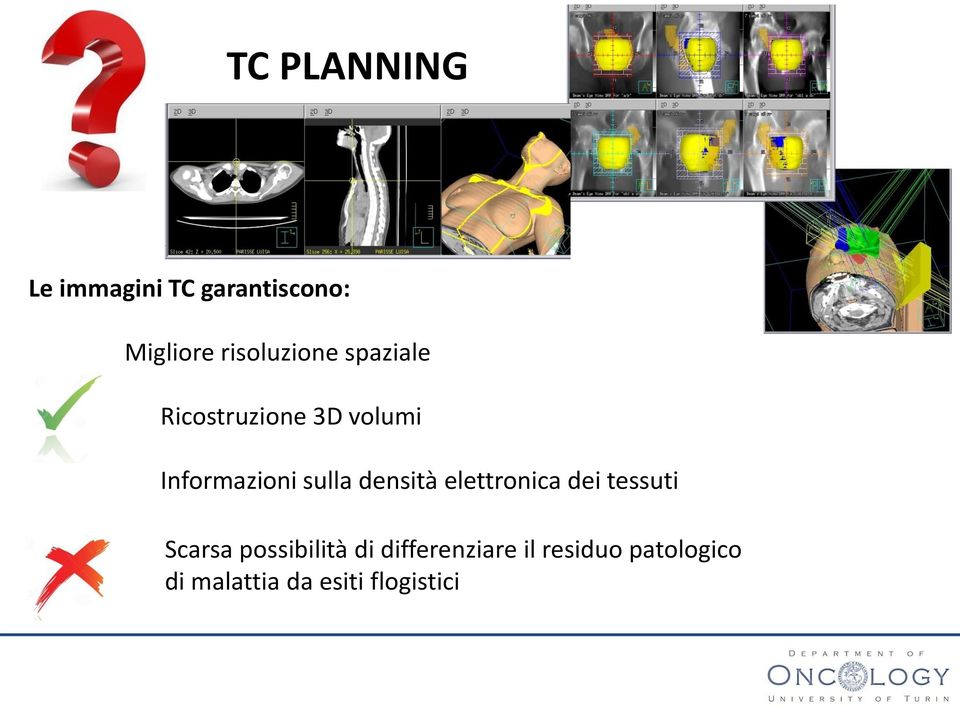 sulla densità elettronica dei tessuti Scarsa possibilità