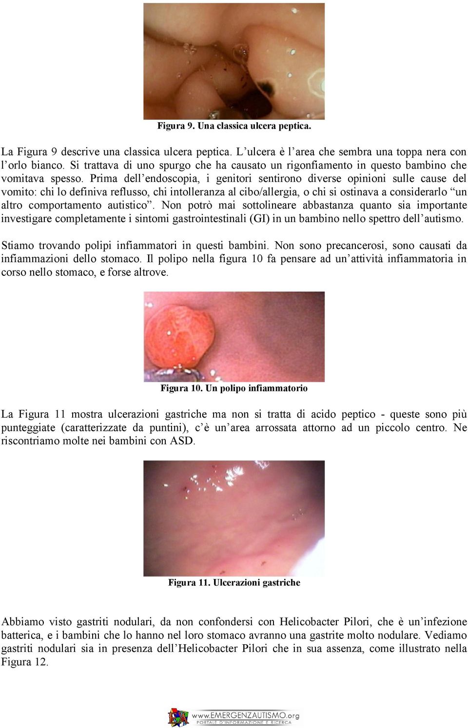 Prima dell endoscopia, i genitori sentirono diverse opinioni sulle cause del vomito: chi lo definiva reflusso, chi intolleranza al cibo/allergia, o chi si ostinava a considerarlo un altro