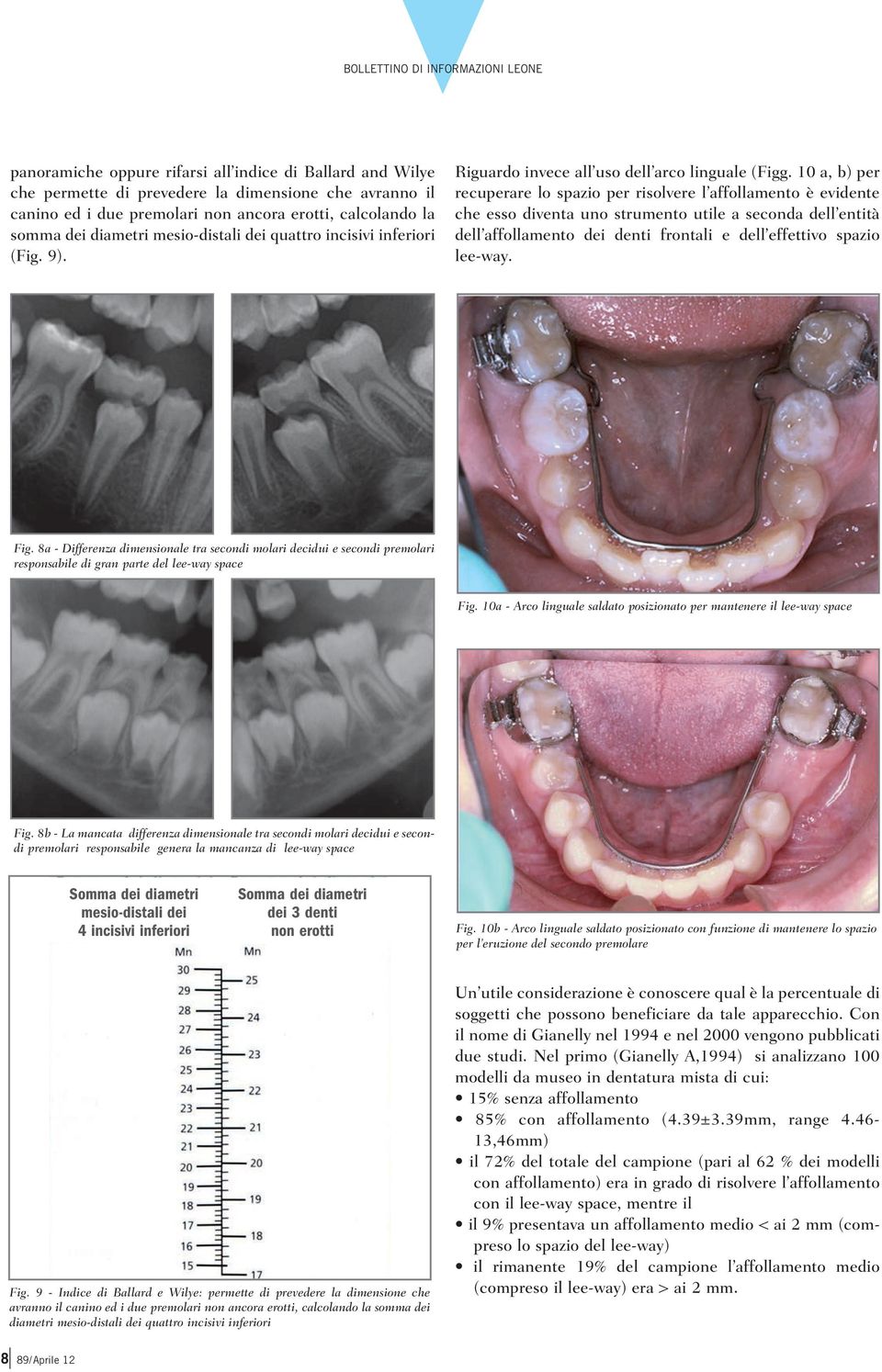 10 a, b) per recuperare lo spazio per risolvere l affollamento è evidente che esso diventa uno strumento utile a seconda dell entità dell affollamento dei denti frontali e dell effettivo spazio