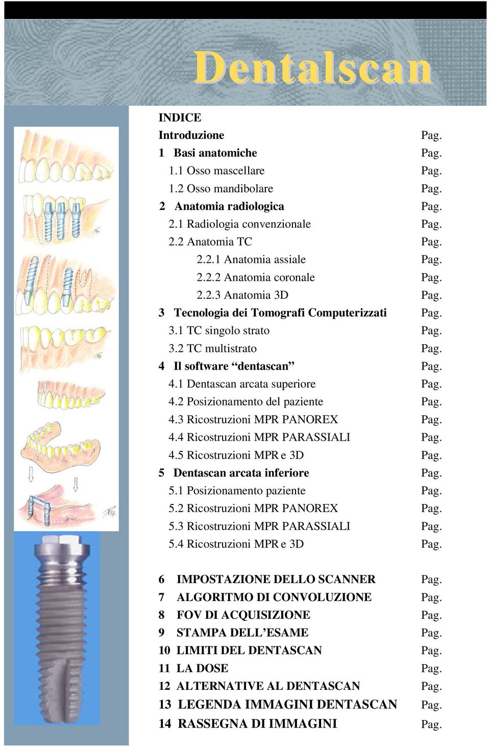 4.2 Posizionamento del paziente Pag. 4.3 Ricostruzioni MPR PANOREX Pag. 4.4 Ricostruzioni MPR PARASSIALI Pag. 4.5 Ricostruzioni MPR e 3D Pag. 5 Dentascan arcata inferiore Pag. 5.1 Posizionamento paziente Pag.