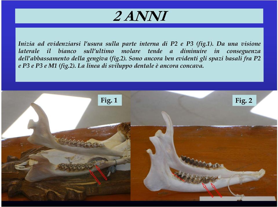 conseguenza dell abbassamento della gengiva (fig.2).