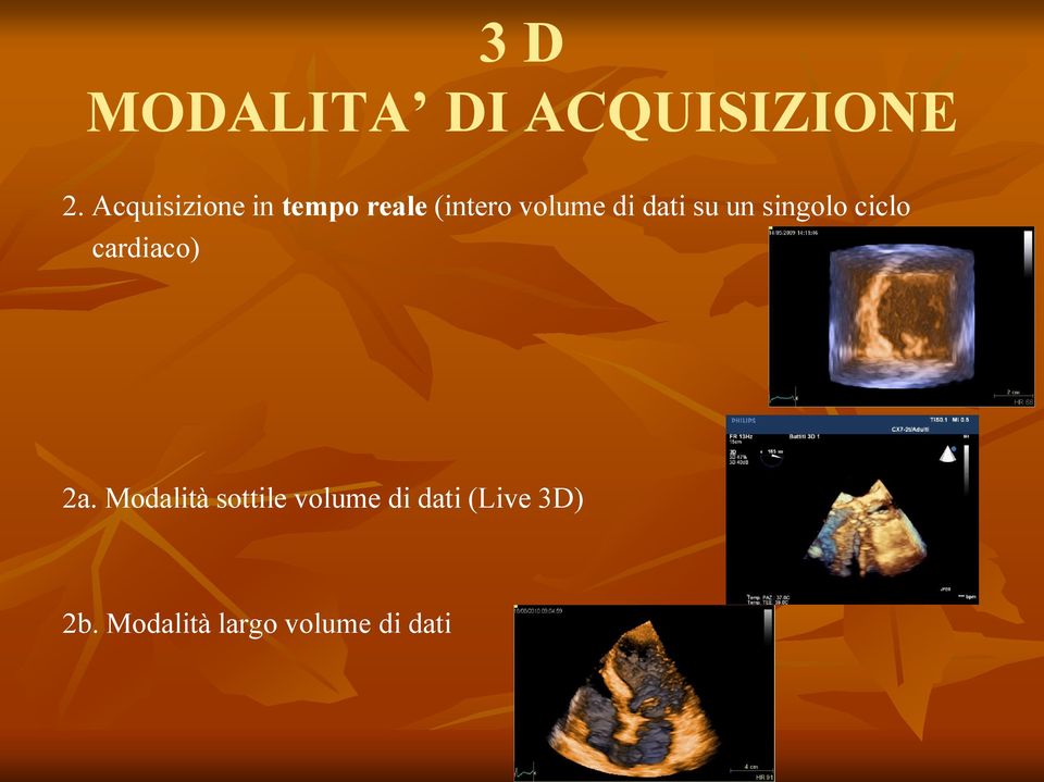 dati su un singolo ciclo cardiaco) 2a.