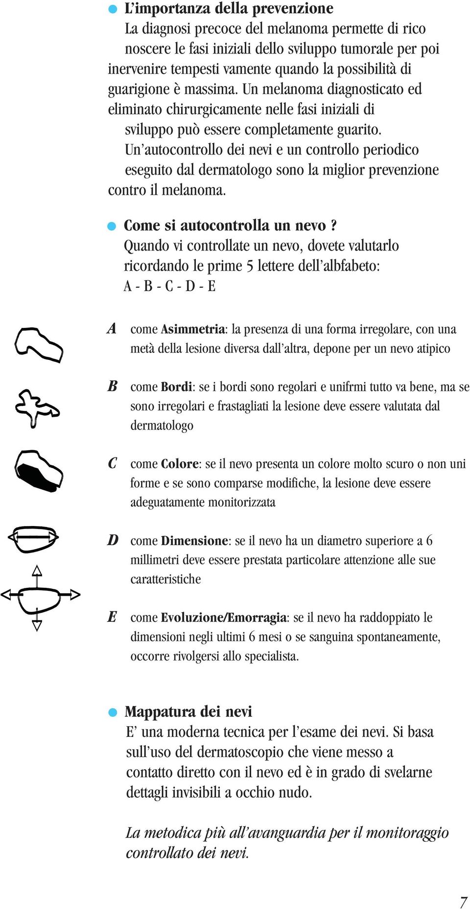 Un autocontrollo dei nevi e un controllo periodico eseguito dal dermatologo sono la miglior prevenzione contro il melanoma. Come si autocontrolla un nevo?