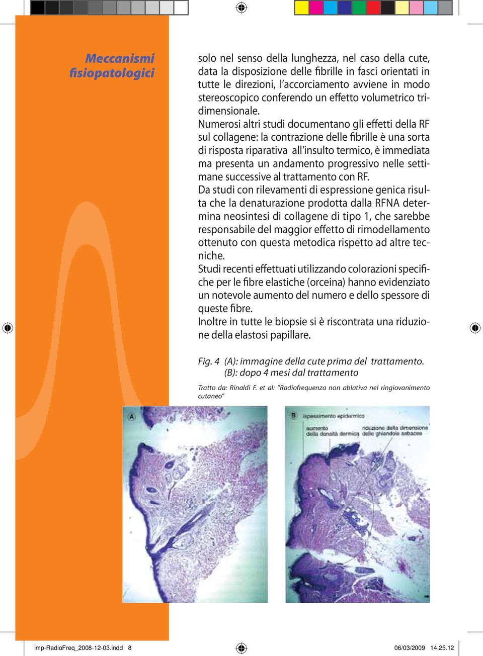 Numerosi altri studi documentano gli effetti della RF sul collagene: la contrazione delle fibrille è una sorta di risposta riparativa all insulto termico, è immediata ma presenta un andamento