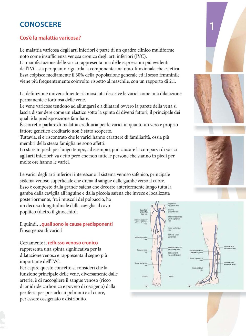 Essa colpisce mediamente il 30% della popolazione generale ed il sesso femminile viene più frequentemente coinvolto rispetto al maschile, con un rapporto di 2:1.