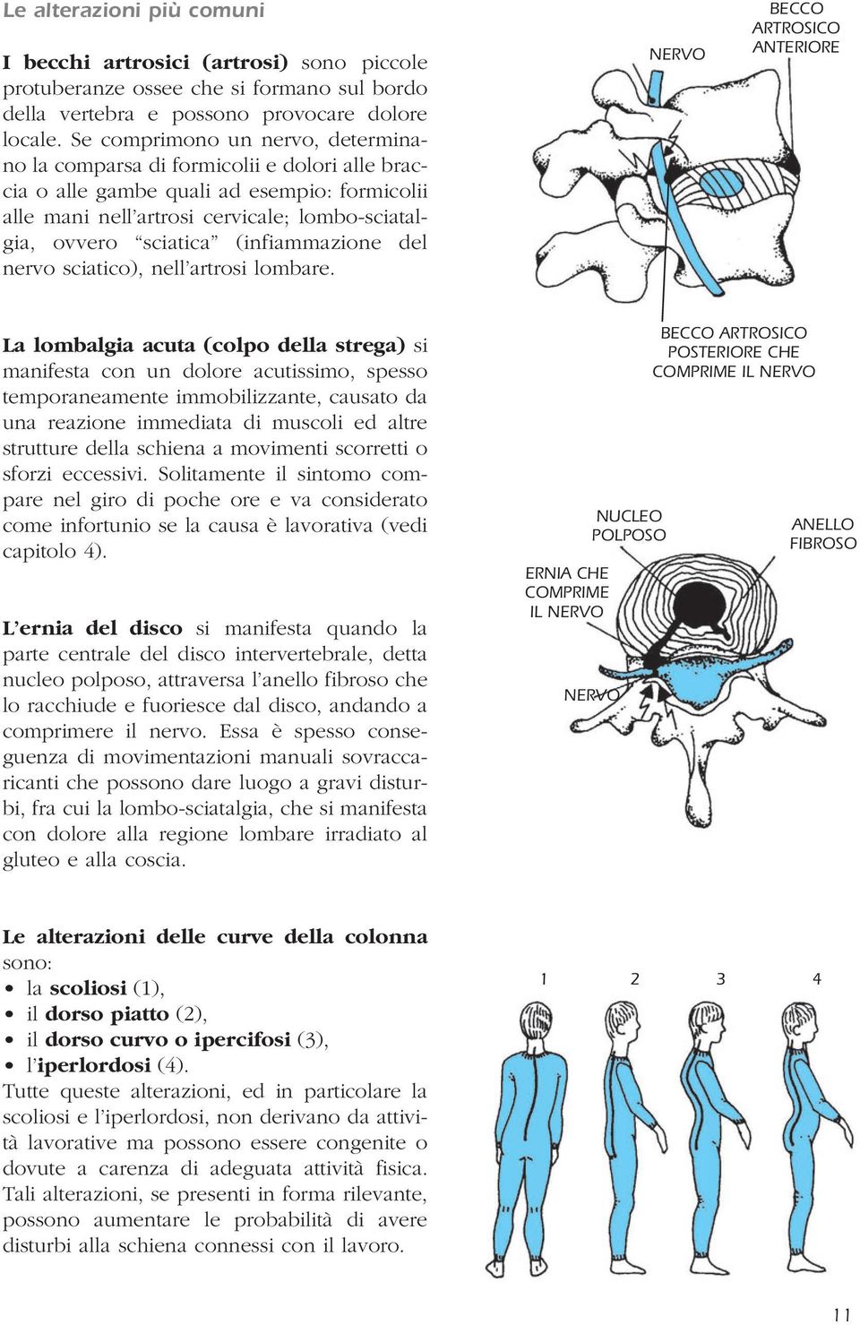 (infiammazione del nervo sciatico), nell artrosi lombare.