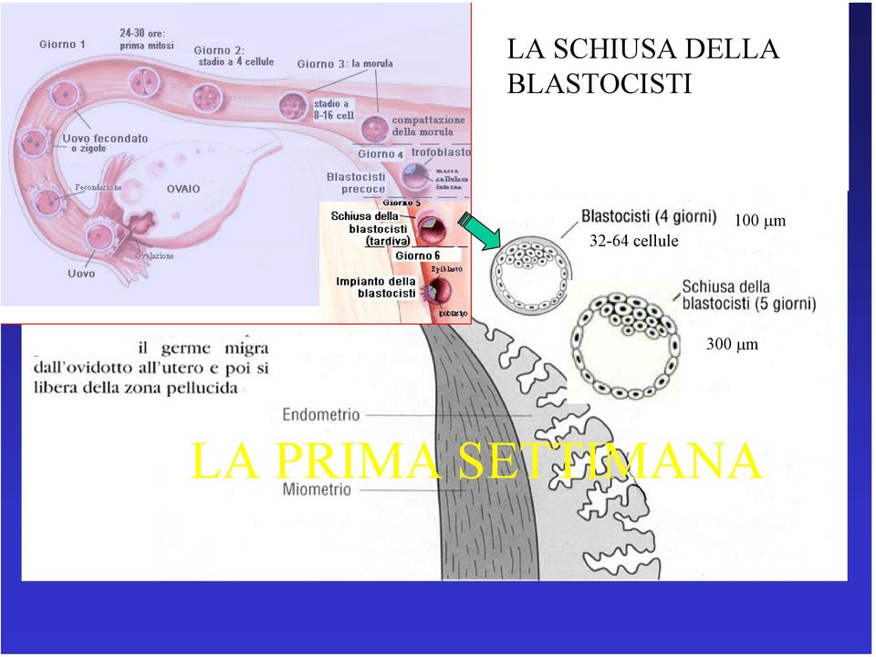 compattazione 32-64