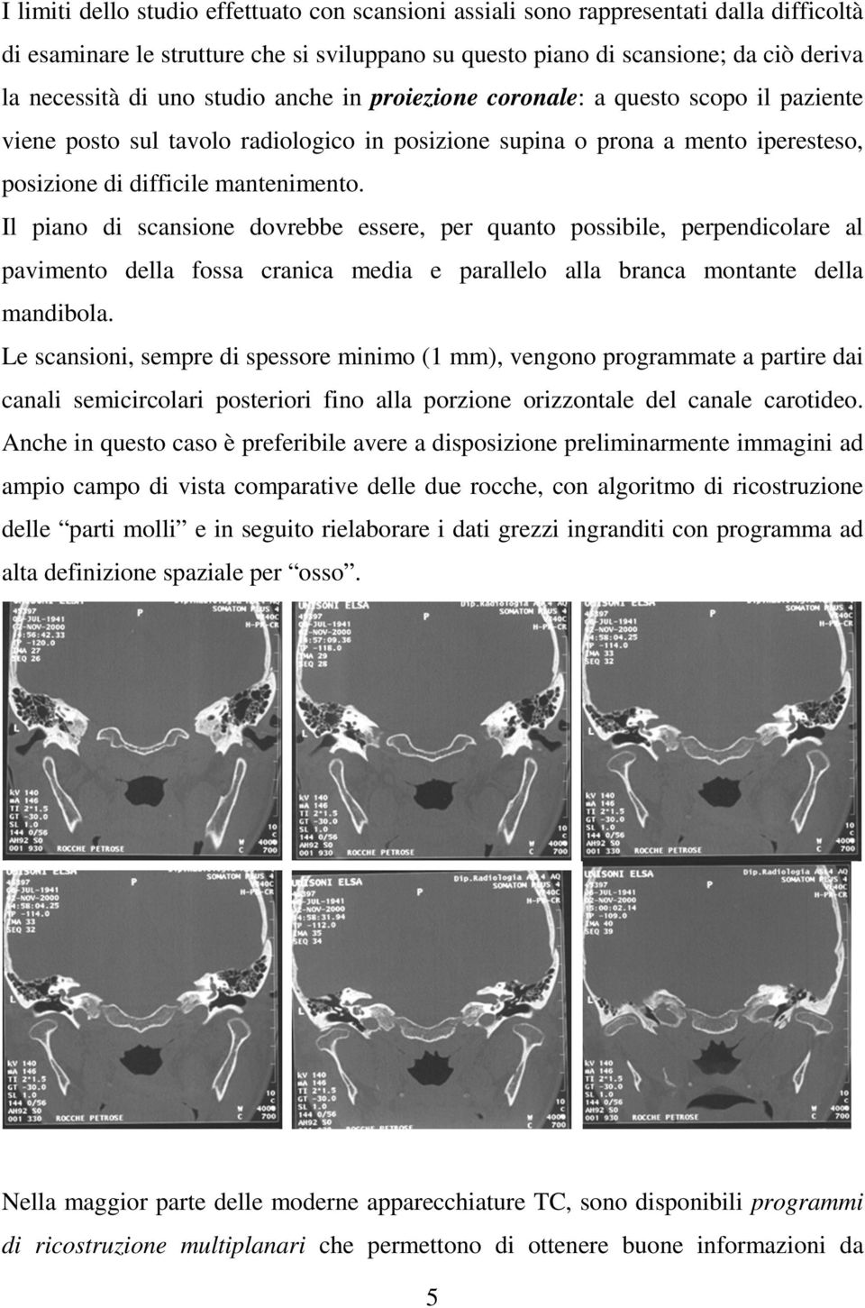 Il piano di scansione dovrebbe essere, per quanto possibile, perpendicolare al pavimento della fossa cranica media e parallelo alla branca montante della mandibola.