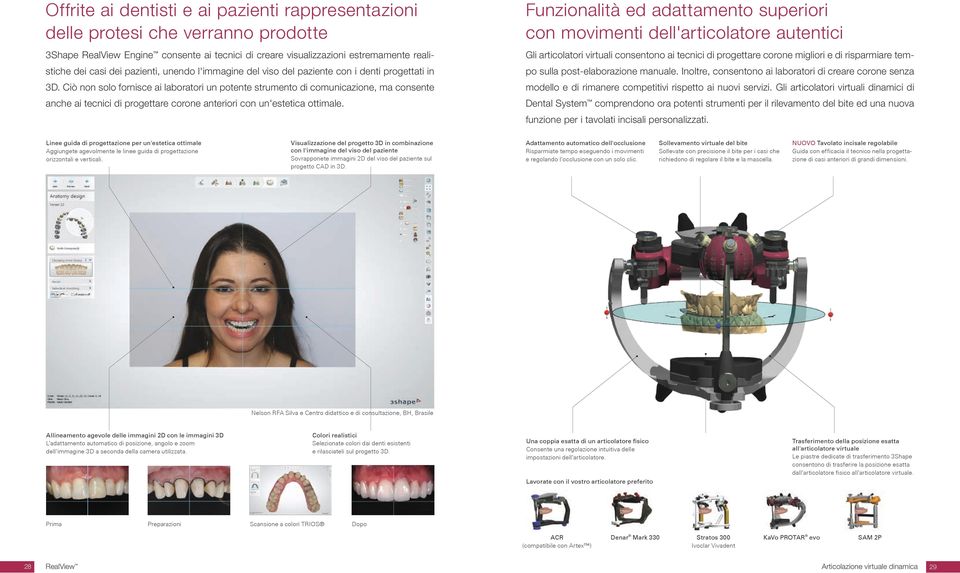 Ciò non solo fornisce ai laboratori un potente strumento di comunicazione, ma consente anche ai tecnici di progettare corone anteriori con un'estetica ottimale.