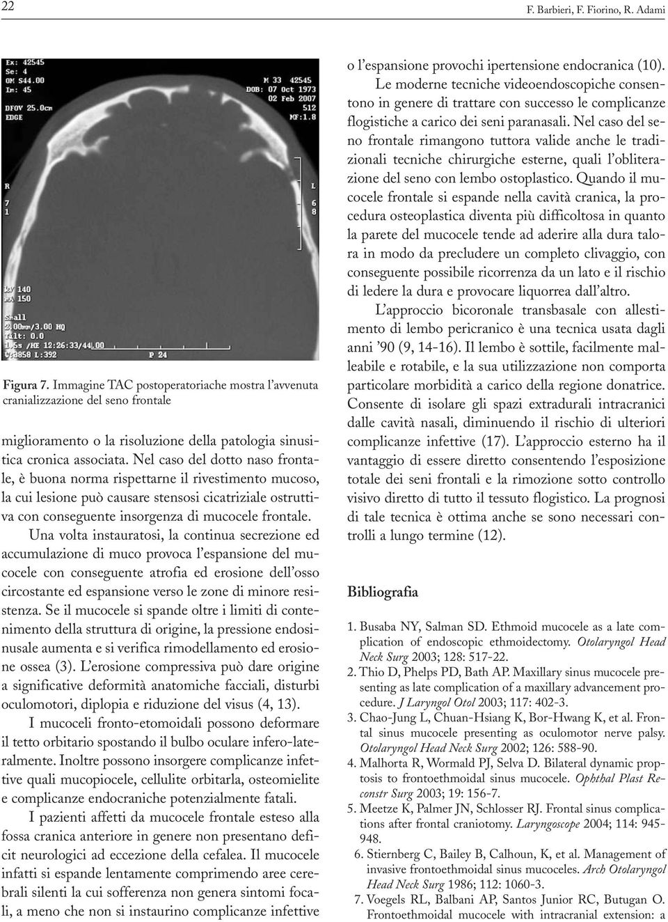 Nel caso del dotto naso frontale, è buona norma rispettarne il rivestimento mucoso, la cui lesione può causare stensosi cicatriziale ostruttiva con conseguente insorgenza di mucocele frontale.