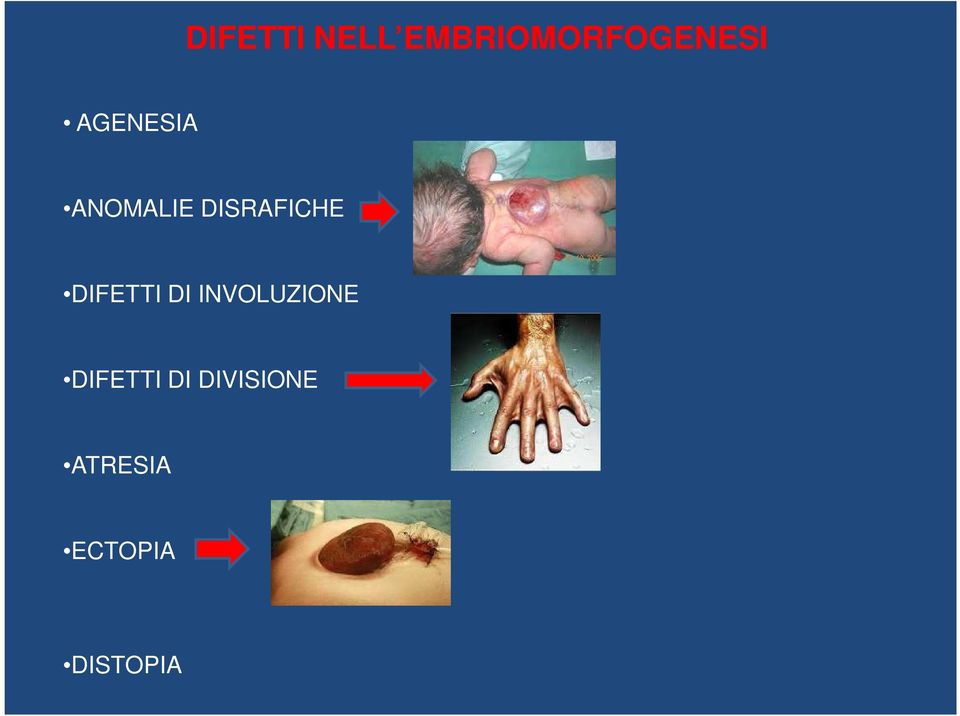 DIFETTI DI INVOLUZIONE DIFETTI