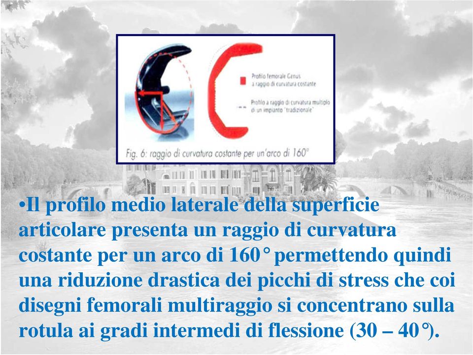 riduzione drastica dei picchi di stress che coi disegni femorali