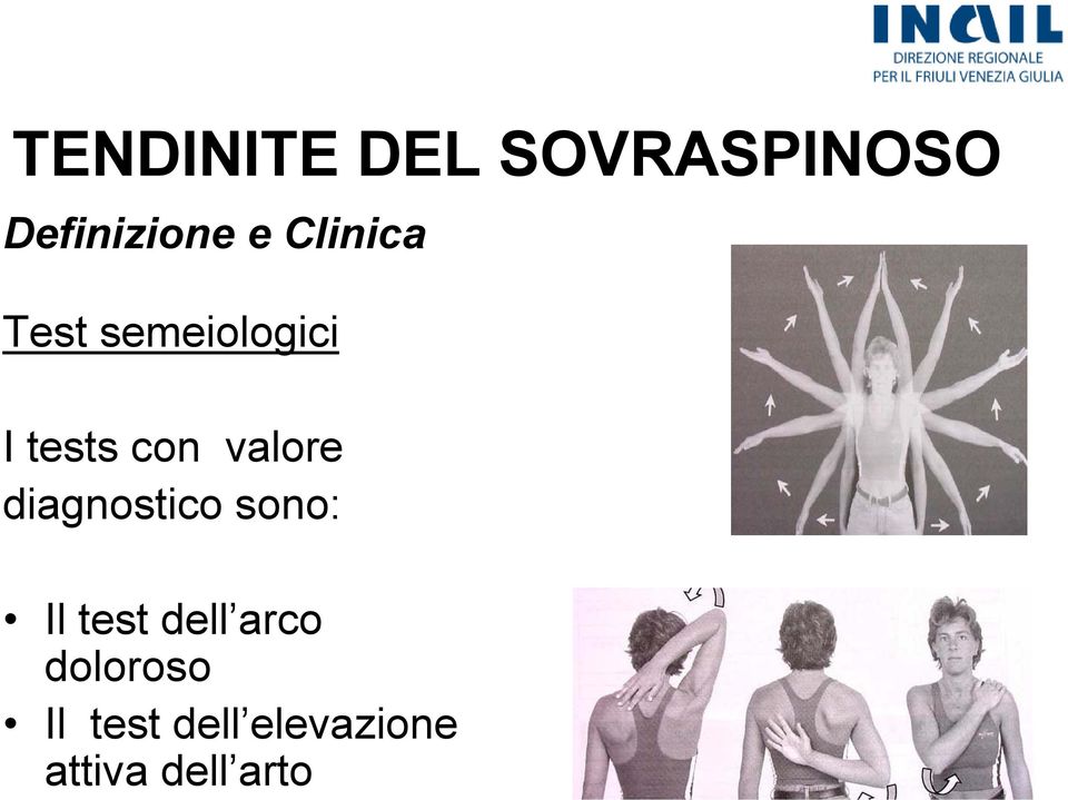 valore diagnostico sono: Il test dell arco