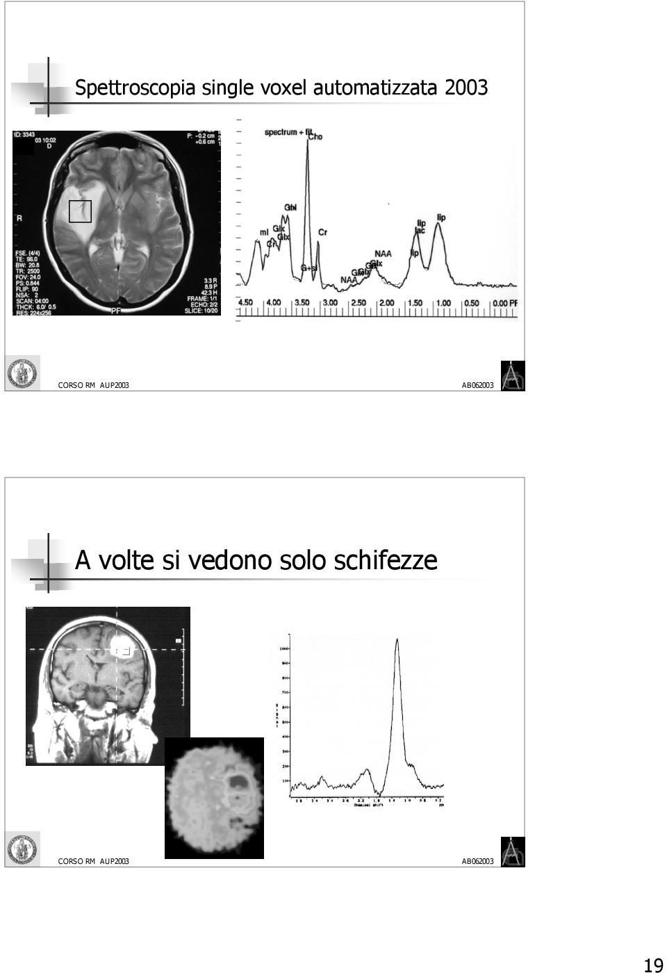 2003 A volte si