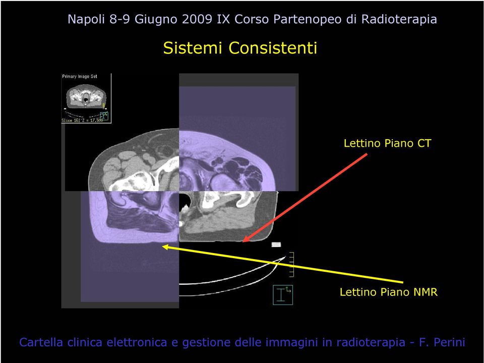 Lettino Piano