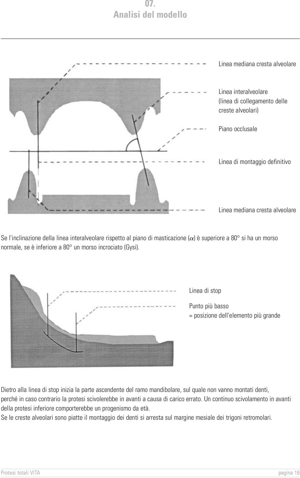 Linea di stop Punto più basso = posizione dell'elemento più grande Dietro alla linea di stop inizia la parte ascendente del ramo mandibolare, sul quale non vanno montati denti, perché in caso