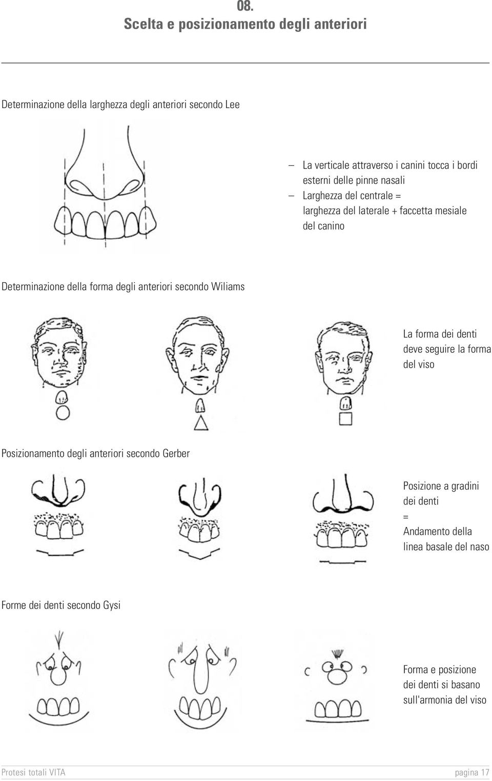 anteriori secondo Wiliams La forma dei denti deve seguire la forma del viso Posizionamento degli anteriori secondo Gerber Posizione a gradini