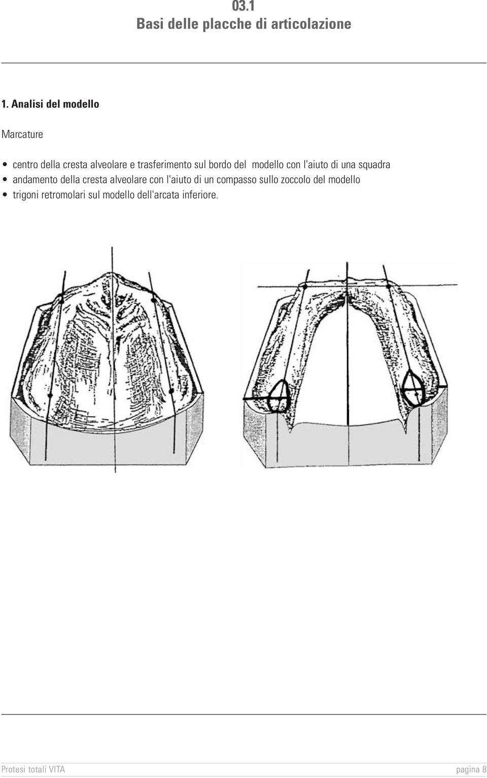 bordo del modello con l'aiuto di una squadra andamento della cresta alveolare