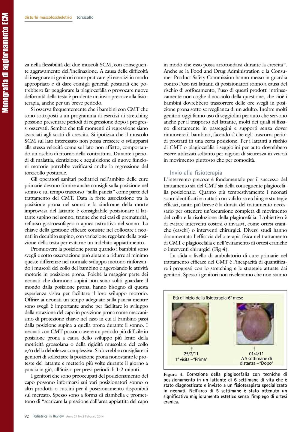 nuove deformità della testa è prudente un invio precoce alla fisioterapia, anche per un breve periodo.