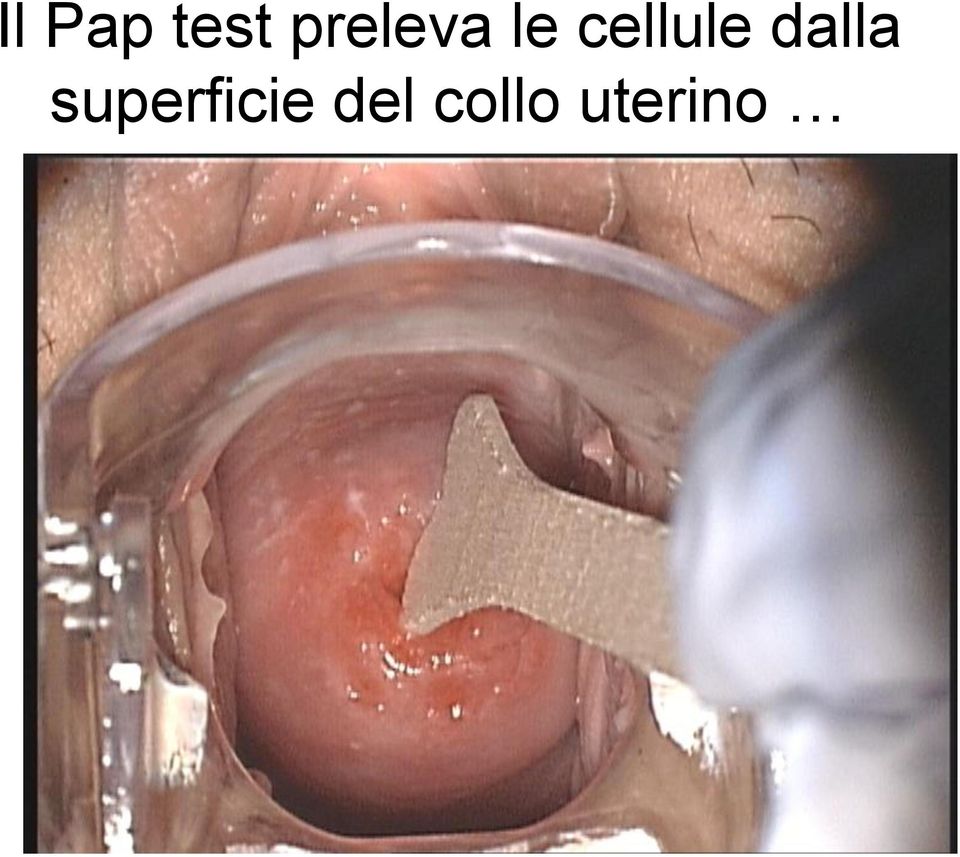 cellule dalla