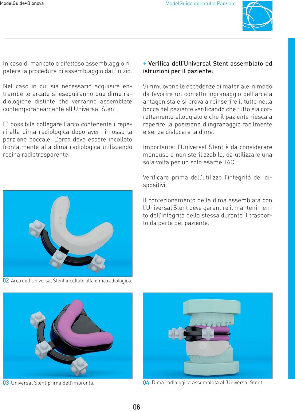 E possibile collegare l arco contenente i reperi alla dima radiologica dopo aver rimosso la porzione boccale.