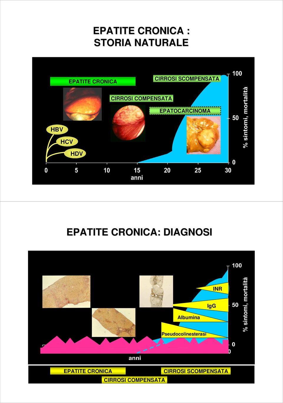 EPATITE CRONICA: DIAGNOSI INR Albumina IgG