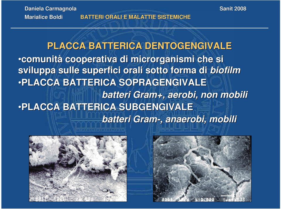 di biofilm PLACCA BATTERICA SOPRAGENGIVALE batteri Gram+,