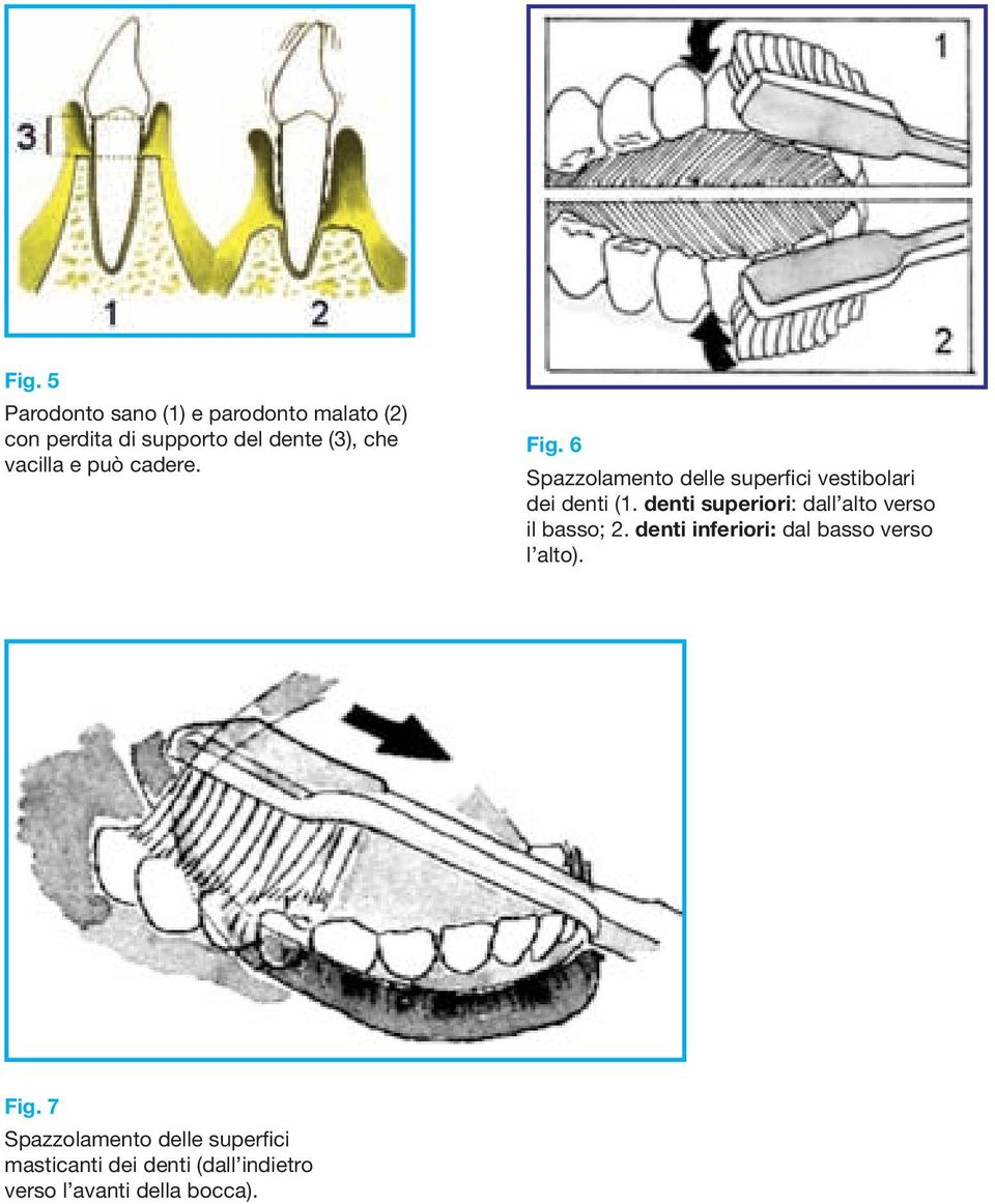 denti superiori: dall alto verso il basso; 2. denti inferiori: dal basso verso l alto). Fig.